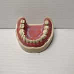 568 Model Lower Ivory-Color Jaw with Edentulous 19, 20, 29, 30, 31